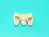 1b-philips-bridge-4years-ago-b4-fitting