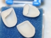 1d-roisin-veneers