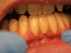 1e-philip-bridge-review-july12