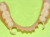 aesthetically-designed-lower-patial
