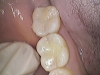 composite-before-2