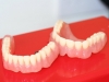 hight-quality-of-dentures