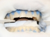 ready-for-in-office-whitening