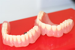 Dentures