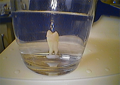 Tooth an a glass of water